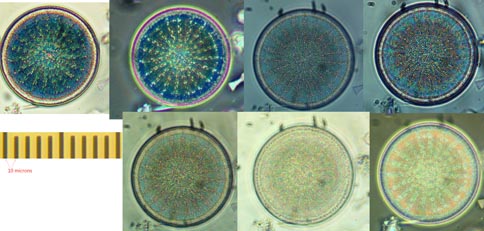 diatom comparison: brightfield, darkfield, phase contrast